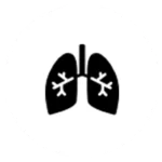 Pleural Effusion (TB Fluid in Lungs)
